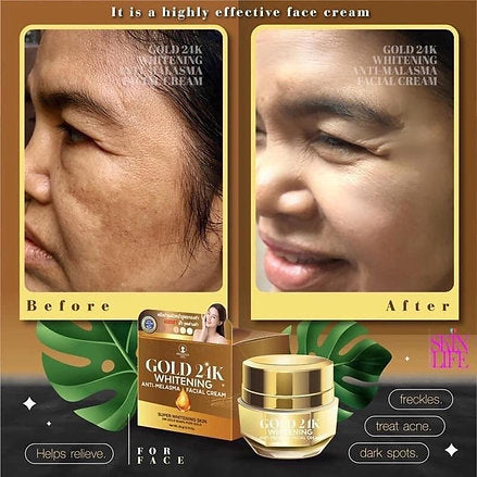 GOLD 24K ANTI-MELASMA