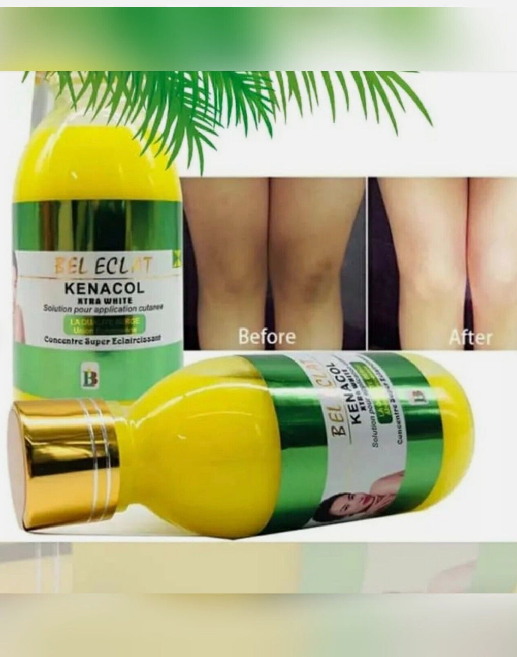 BEL ECLAT KENACOL SOLUTION concentre super ecclaircissant